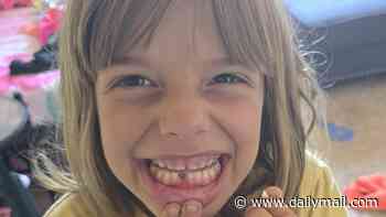 California girl, 7, is SCALPED by pack of six vicious stray dogs while playing outside