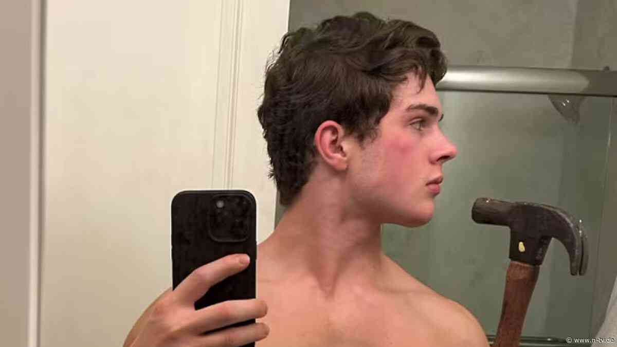 Alpha-Bros mit Rechtsdrall: Spritze in den Penis, Hammer ins Gesicht - was ist Looksmaxxing?