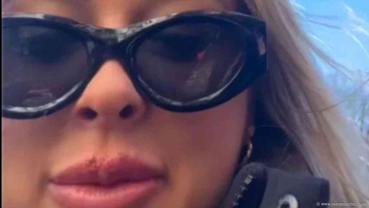 ‘I suffered with constant cold sores, but £10 balm has nearly rid them entirely’ 