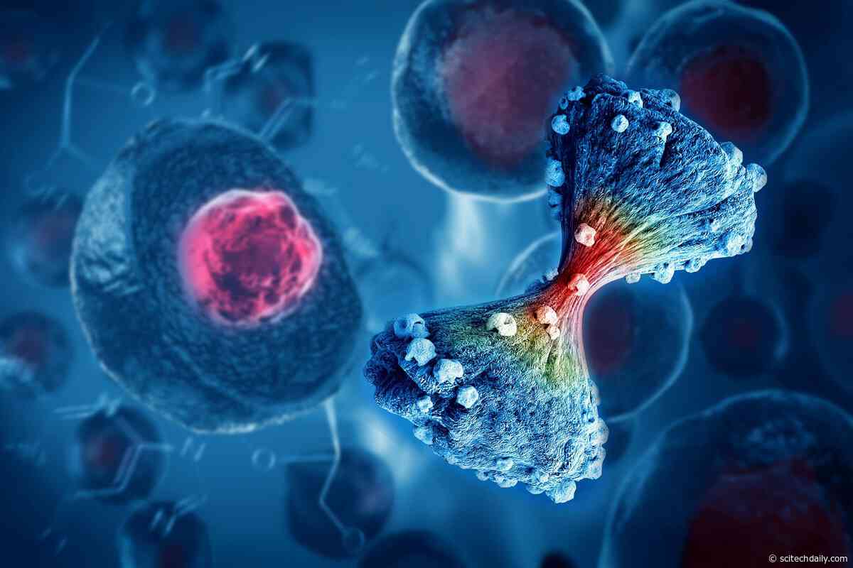 Scientists Warn: Colorectal Cancer Is Rising Fast in Younger Adults, Reversing Decades of Progress