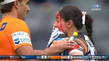 Tigers hooker bloodied after head clash