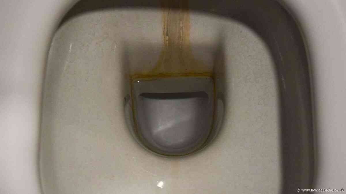 Toilets will be free of limescale and stains when 1 overlooked task is done