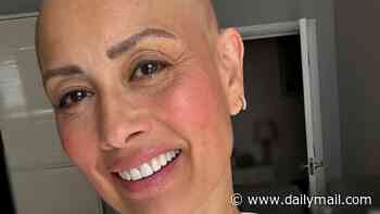 The celebrities who have opened up about battling alopecia after Melanie Sykes revealed condition caused 'two-thirds' of her hair to fall out