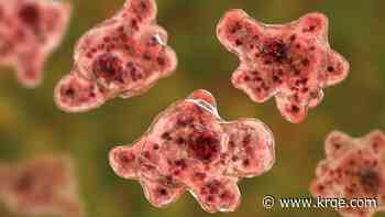 It's brain-eating amoeba season. Here's how to protect yourself