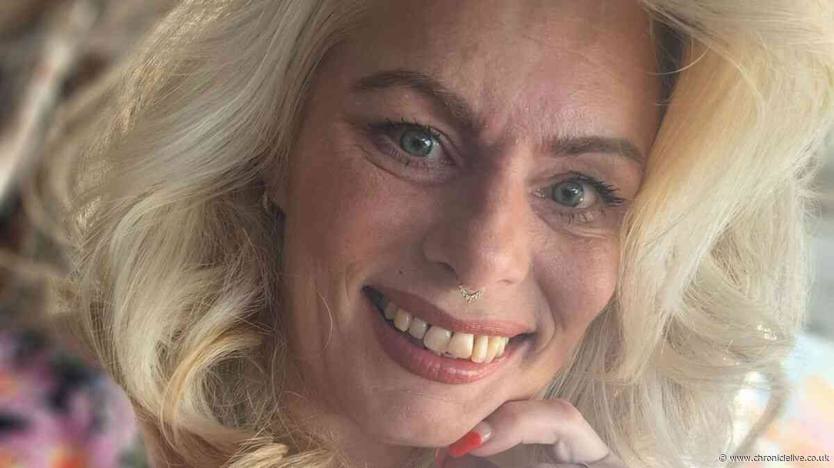 Mum who lost teeth in brutal mistaken identity attack desperately tries to raise cash for new smile