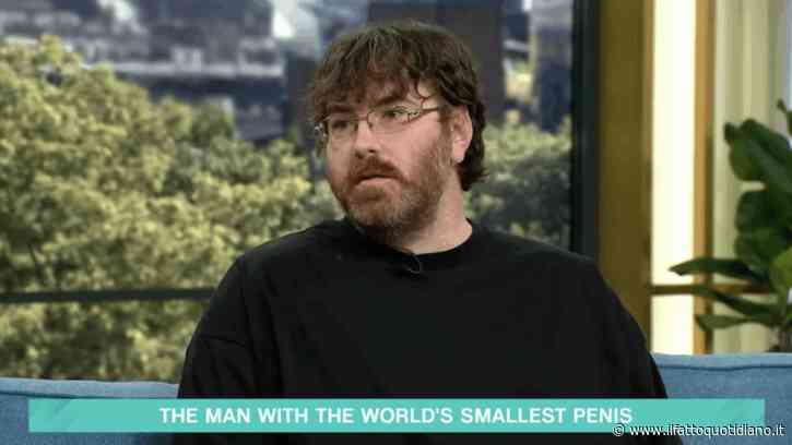 “Il mio pene è il più piccolo del mondo e misura 1 centimetro, adesso posso fare l’operazione per ingrandirlo”: la storia di Michael Phillips