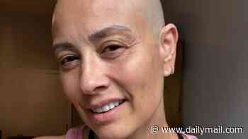 Melanie Sykes proudly shows off her bald head as a 'Monday motivation' after losing 'two-thirds' of her hair during alopecia battle