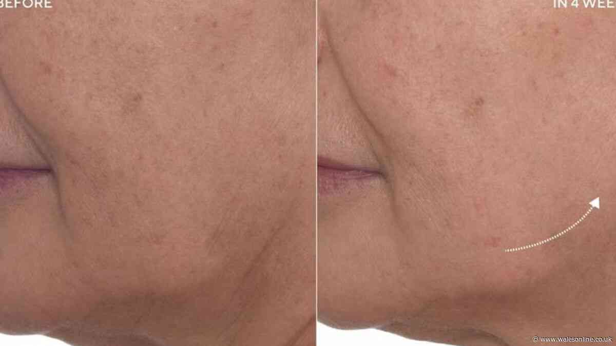 Beauty fans race to Debenhams for £40 set that stars full size £98 anti-ageing cream