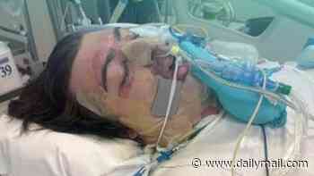 Aussie man in critical condition after robot vacuum explodes in freak accident