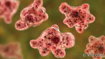 It's brain-eating amoeba season. Here's how to protect yourself