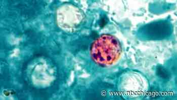 Cases of ‘explosive' diarrhea parasite soaring in Michigan, Illinois
