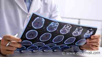 MS breakthrough as researchers find new way to spot previously undetectable brain lesions - as cases surge in young people