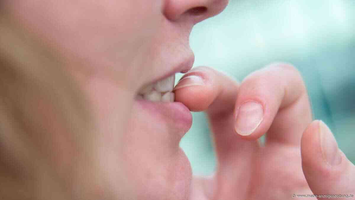 Nägelkauen stoppen: Was hilft?