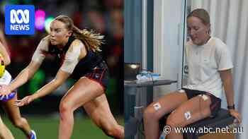 With women's game short on resources this AFLW player went to Doha for ACL rehab