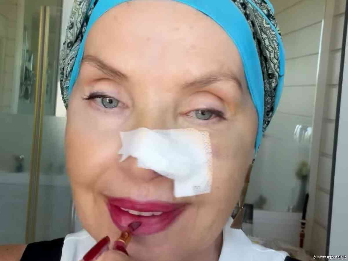 Nadia Mayer operata per un tumore alla pelle: cos'è il basalioma che ha colpito la star di "Casa a Prima Vista"