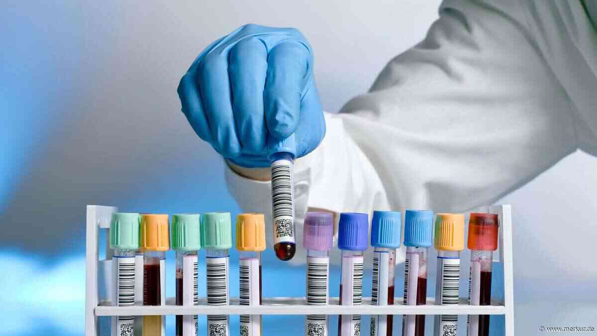 Neuer Alzheimer-Check: Sieben weitere Bluttests, die sogar von Krankenkassen bezahlt werden
