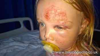 Toddler fractures skull during trip as nursery suspended