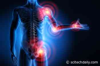 New Calculator Reveals Your Real Risk of Statin Side Effects