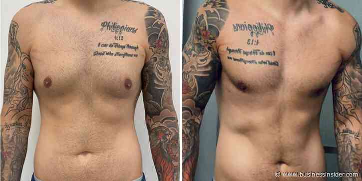 Men get cosmetic surgery, too. I spent $14,000 on plastic surgery, and I don't regret it.