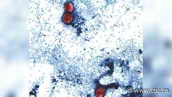 A diarrhea-causing parasite has infected more than 1,000 in the U.S. Is it in Canada?