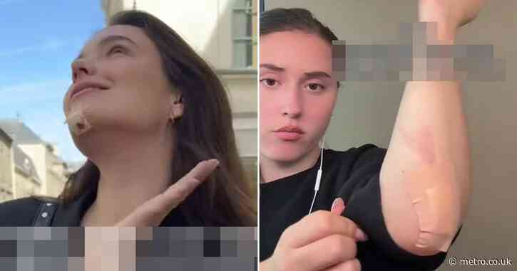 Shoppers call out high street brand after being injured wearing ‘deadly’ trousers