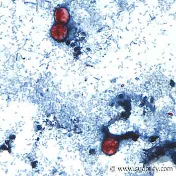 Diarrhea-causing parasite infecting more than 1,200 in Michigan has not spread to Canada: PHAC