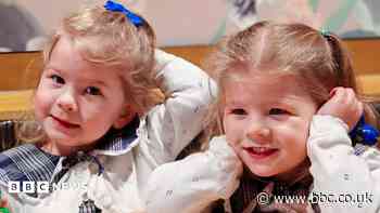 Pioneering treatment saves identical twins from rare pregnancy condition