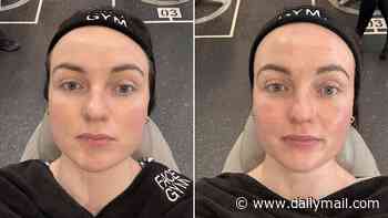 SPA DOCTOR: I've never been happy with my jawline - but this 45-minute £110 treatment gave me the snatched look I've always wanted
