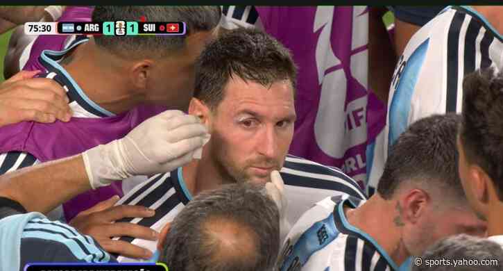 🩸 Messi bleeding above the eye, treated on the touchline 🧑‍⚕️
