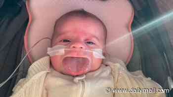Baby Lulu's brave battle as rare genetic disorder causes tongue to grow to an enormous size - as family's world is turned upside down