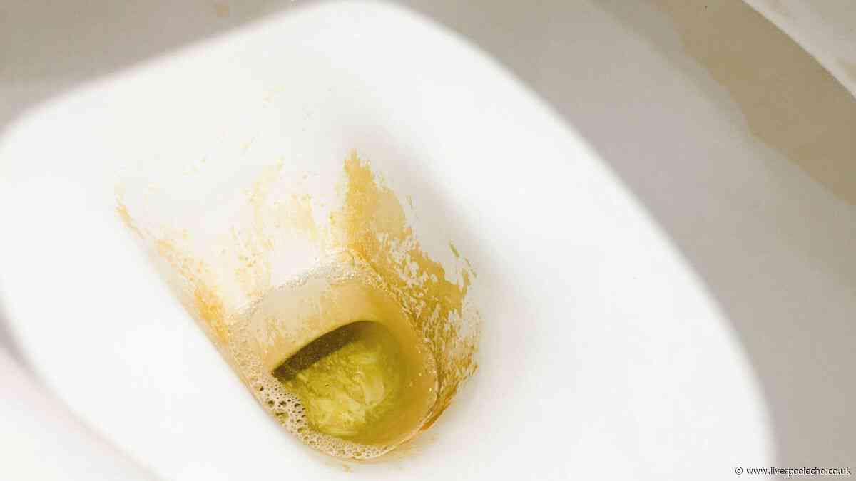 Forget bleach — 25p tablet removes stubborn brown toilet stains for good