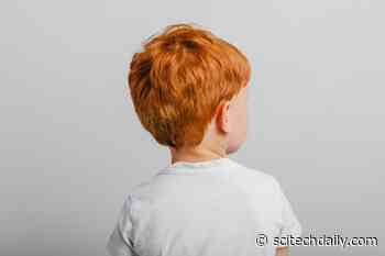The Surprising Cellular Benefit of the Pigment Behind Red Hair