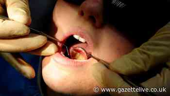 Fluoride varnish treatment being rolled out to youngsters in Redcar and Cleveland