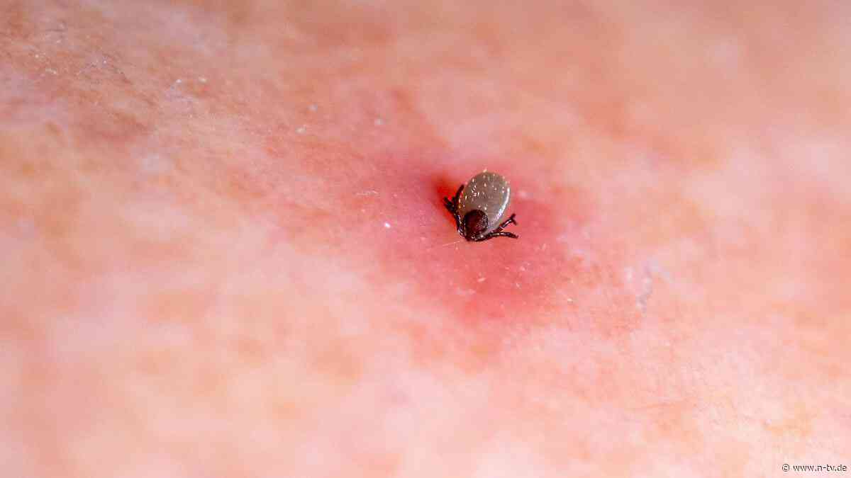 Richtig handeln: Was nach einem Zecken-Stich wirklich wichtig ist