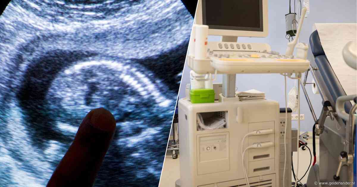 Wettelijk toegestaan, maar wel gevoelig: ziekenhuizen starten proef met late abortussen