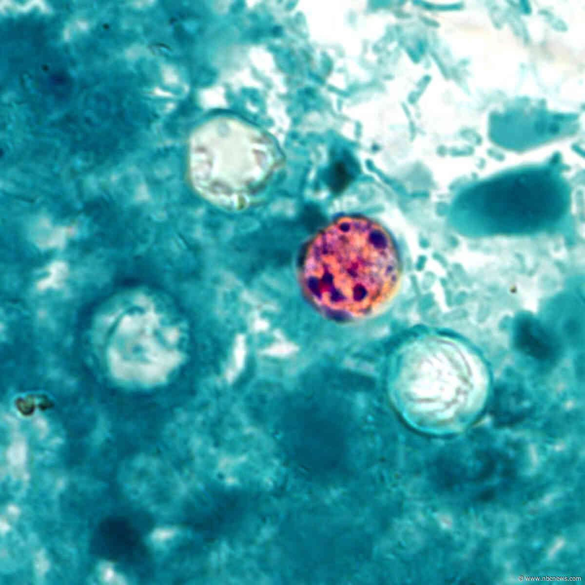 At least 86 hospitalized with foodborne parasite spreading across the U.S., CDC says