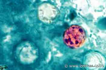 Cyclospora Mode of Transmission: How the Parasite Is Spreading Across the US, Causing 'Explosive Diarrhoea'