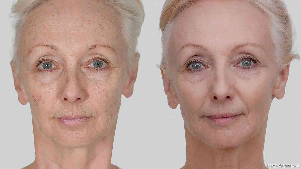 Debbie McGee, 67, reveals the results of her 'life-changing' non-surgical facelift as she says 'I look better than I did in my 40s'