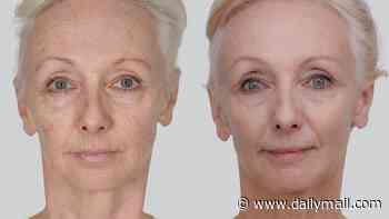 Debbie McGee, 67, reveals the results of her 'life-changing' non-surgical facelift as she says 'I look better than I did in my 40s'