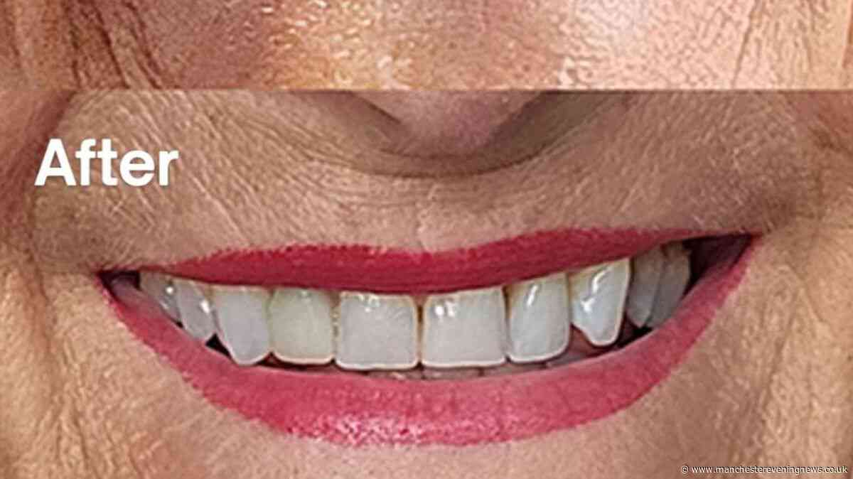 Tea drinker asks brother 'why teeth are so good' and 32p-a-day buy gets 'confidence back'