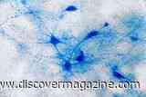 Long COVID May Affect Motivation and Memory by Injuring the Brain&rsquo;s Dopamine System
