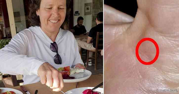 Woman bitten by bat on holiday ‘saved from rabies’ after using Google Lens