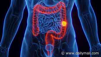 Major treatment flaw could be fuelling explosion in bowel cancer deaths among under 50s, study suggests - as cases continue to climb