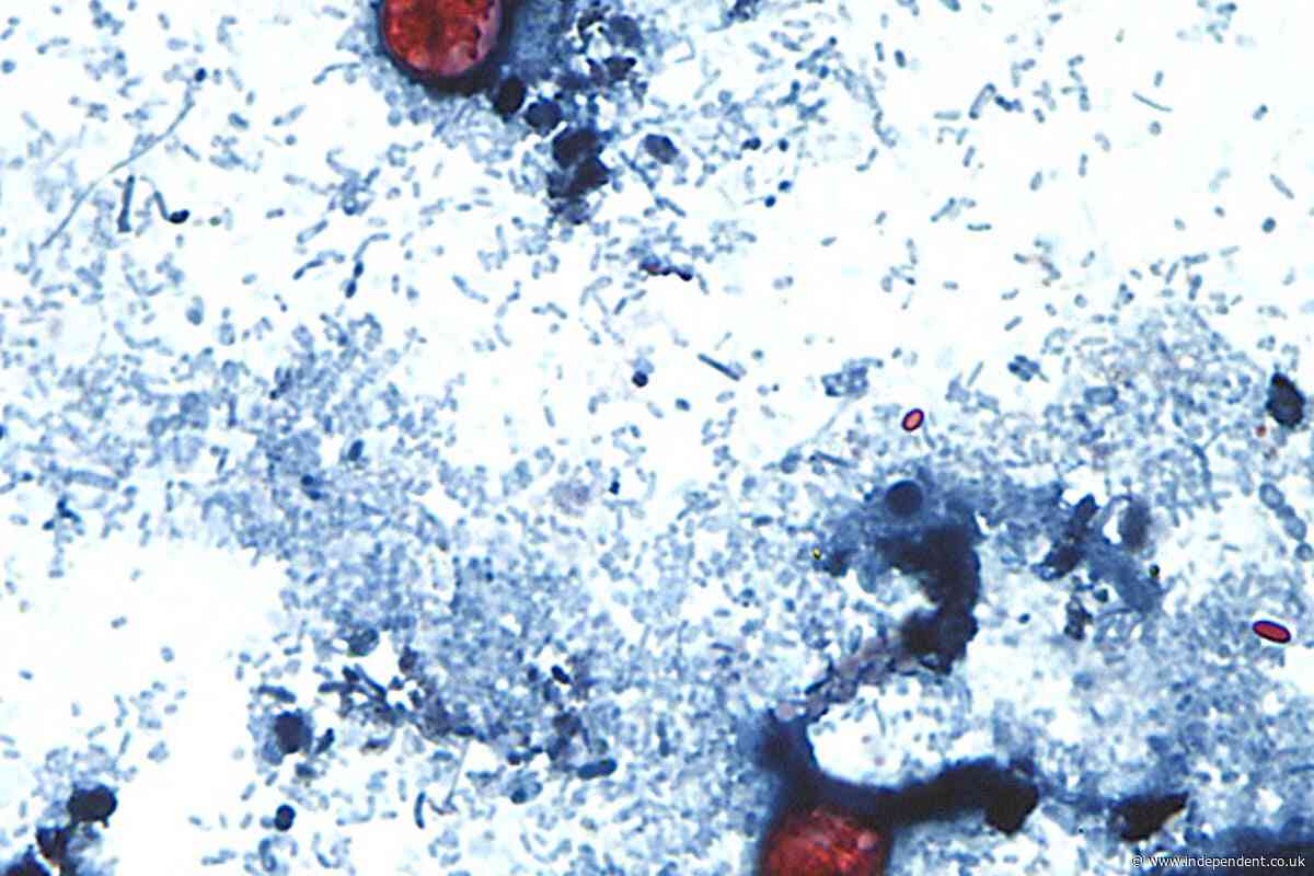 Spread of ‘explosive diarrhea’ parasite in US could be far worse than we know thanks to Trump cuts