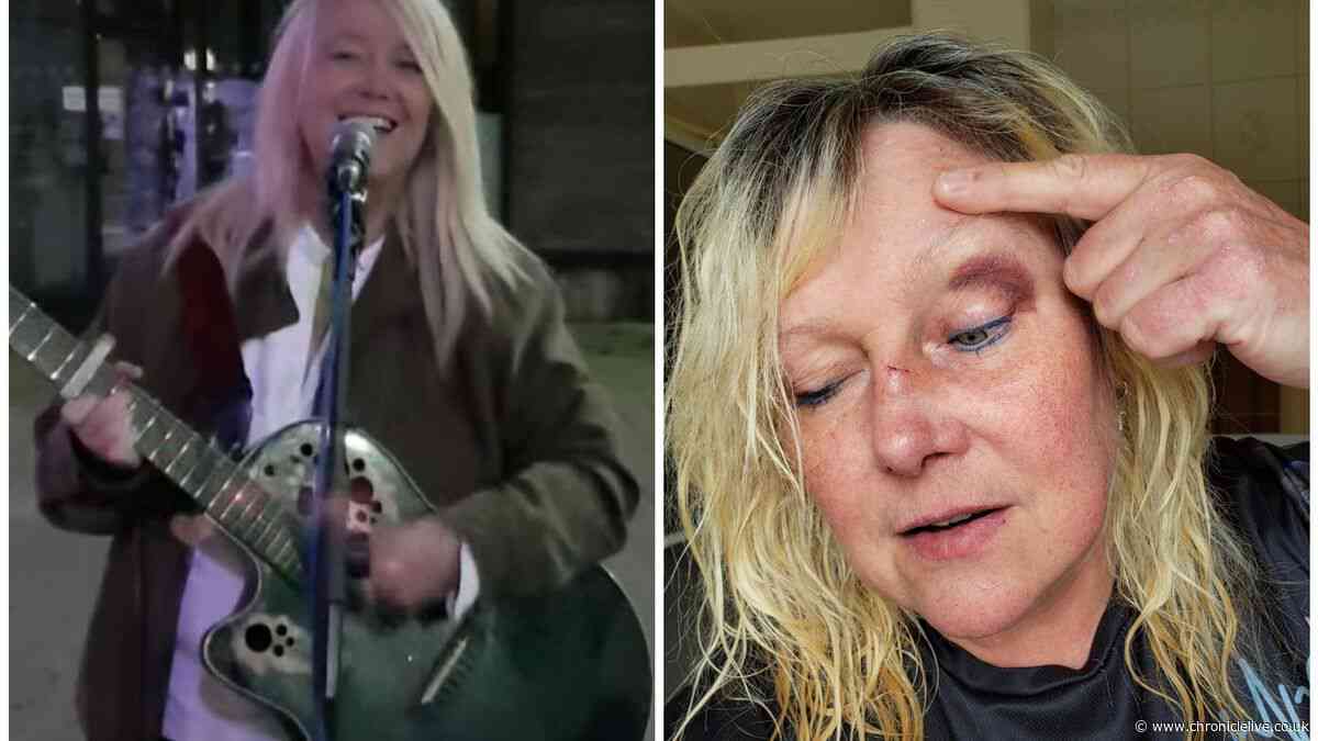 North East singer 'hit with her own guitar' and left bleeding after England World Cup win