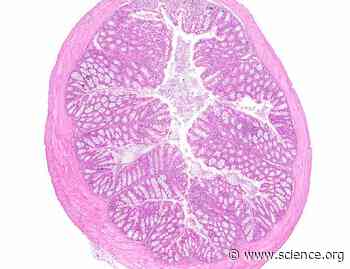 The E3 ligase TRIM13 restrains LPS-induced inflammation by reducing STIM1 abundance and the IRE1α-dependent unfolded protein response | Science Signaling