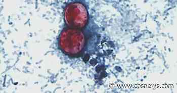 CDC and Georgia health officials work to identify cause of cyclospora spike