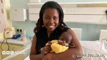 'Miracle' baby born at 22 weeks goes home