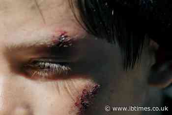 Polish Man Allegedly Attacks 'Ukrainian' Speaker Who Turned Out to Be Fellow Pole