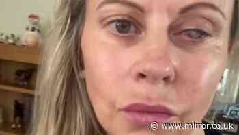 Mum's eye eaten by parasites after making simple mistake while washing her face